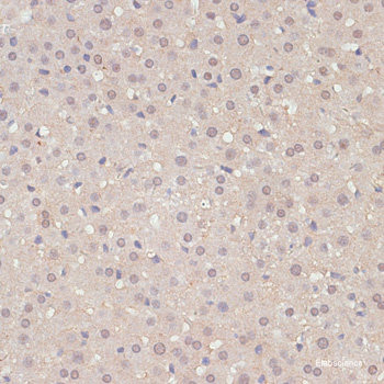 Western blot analysis of extracts of Mouse brain using LCAT Polyclonal Antibody at dilution of 1:3000.