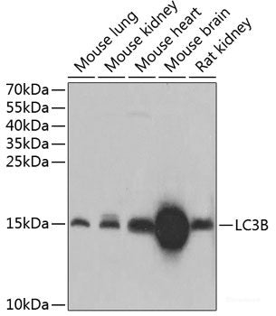 Western blot analysis of extracts of various cell lines using MMP13 Polyclonal Antibody at dilution of 1:1000.