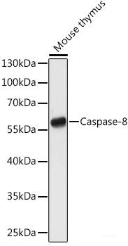Western blot analysis of extracts of various cell lines using CAT Polyclonal Antibody at dilution of 1:3000.