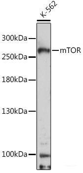Western blot analysis of extracts of various cell lines using TARDBP Polyclonal Antibody at dilution of 1:1000.