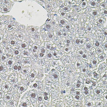 Immunofluorescence analysis of C6 cells using KRAS Polyclonal Antibody at dilution of 1:100. Blue: DAPI for nuclear staining.