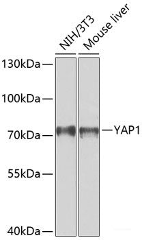 Western blot analysis of extracts of HCT116 cells using β-catenin Polyclonal Antibody at dilution of 1:1000.