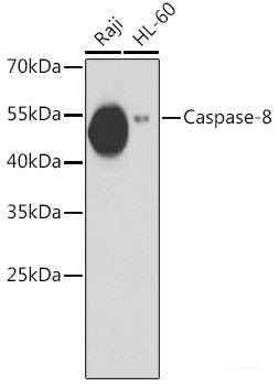 Immunohistochemistry of paraffin-embedded Rat heart using FHIT Polyclonal Antibody at dilution of 1:100 (40x lens).