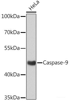 Western blot analysis of extracts of 293T cells using KDM3A Polyclonal Antibody at dilution of 1:1000.