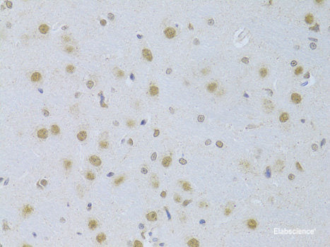 Immunofluorescence analysis of HeLa cells using KLRK1 Polyclonal Antibody at dilution of 1:100. Blue: DAPI for nuclear staining.