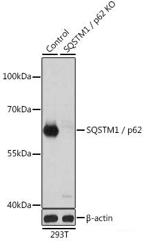 Immunohistochemistry of paraffin-embedded Mouse spleen using PD-1 Polyclonal Antibody at dilution of 1:200 (40x lens).