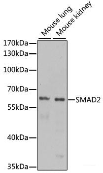 Western blot analysis of extracts of Rat lung using TNFSF10 Polyclonal Antibody at dilution of 1:3000.