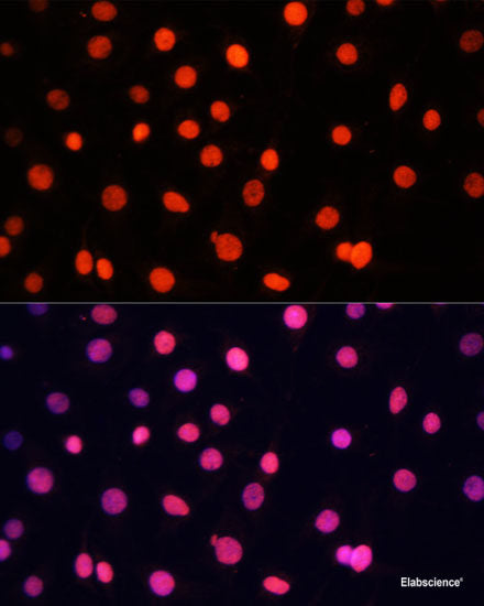 Immunohistochemistry of paraffin-embedded Rat lung using IGF1 Polyclonal Antibody at dilution of 1:100 (40x lens).