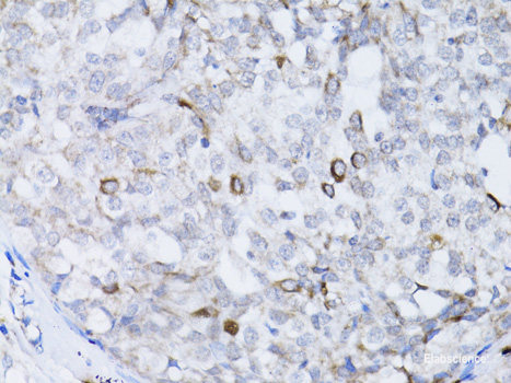 Immunohistochemistry of paraffin-embedded Mouse lung using FGF10 Polyclonal Antibody at dilution of 1:100 (40x lens).