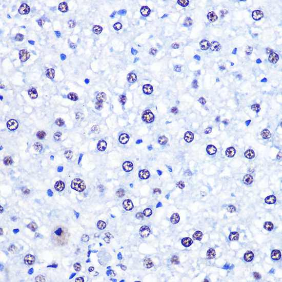 Western blot analysis of extracts of Rat brain using ZSCAN4 Polyclonal Antibody at dilution of 1:3000.