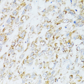 Western blot analysis of extracts of Mouse heart using MMP3 Polyclonal Antibody at dilution of 1:1000.