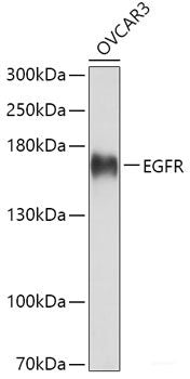 Western blot analysis of extracts of various cell lines using GLMN Polyclonal Antibody at dilution of 1:3000.