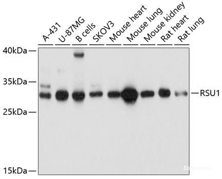 Western blot analysis of extracts of various cell lines using OPLAH Polyclonal Antibody at dilution of 1:3000.