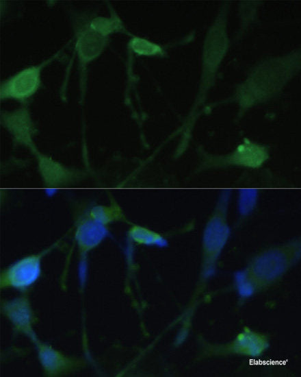 Western blot analysis of extracts of HT-29 cells using KLK6 Polyclonal Antibody at dilution of 1:1000.