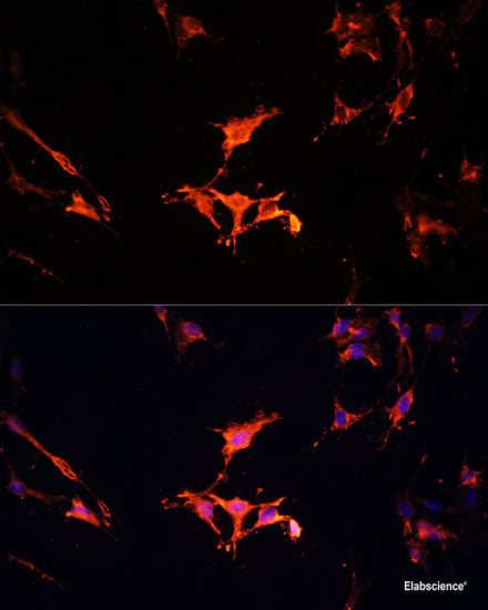 Western blot analysis of extracts of Mouse brain using INADL Polyclonal Antibody at dilution of 1:1000.