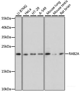 Western blot analysis of extracts of Mouse brain using RAB6A Polyclonal Antibody at dilution of 1:3000.