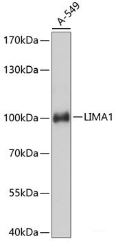 Western blot analysis of extracts of Mouse liver using PTPRR Polyclonal Antibody at dilution of 1:3000.