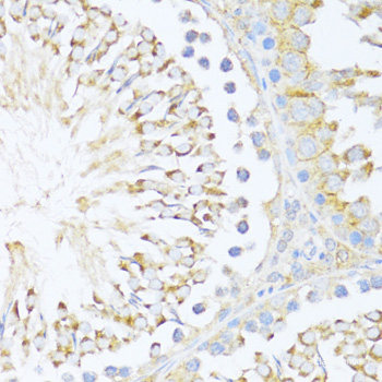 Immunofluorescence analysis of HeLa cells using NET1 Polyclonal Antibody