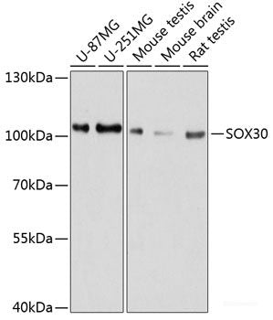 Western blot analysis of extracts of various cell lines using CCT7 Polyclonal Antibody at dilution of 1:3000.