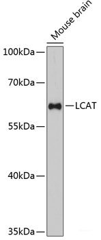 Immunofluorescence analysis of U2OS cells using PMEPA1 Polyclonal Antibody at dilution of 1:100. Blue: DAPI for nuclear staining.