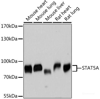 Western blot analysis of extracts of various cell lines using POFUT2 Polyclonal Antibody at dilution of 1:1000.