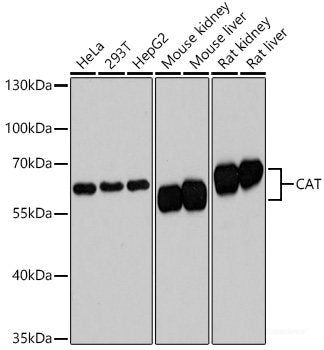 Confocal immunofluorescence analysis of HeLa cells using RRBP1 Polyclonal Antibody at dilution of 1:100. Blue: DAPI for nuclear staining.