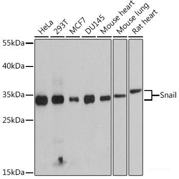 Western blot analysis of extracts of Mouse liver using PPT2 Polyclonal Antibody at dilution of 1:3000.