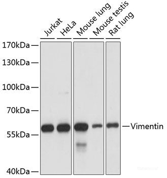 Western blot analysis of extracts of HeLa cells using CAPN3 Polyclonal Antibody at dilution of 1:3000.