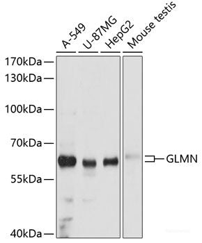 Immunofluorescence analysis of NIH-3T3 cells using GPC3 Polyclonal Antibody at dilution of 1:100 (40x lens). Blue: DAPI for nuclear staining.