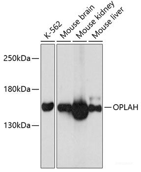 Western blot analysis of extracts of Mouse brain using CAPNS2 Polyclonal Antibody at dilution of 1:3000.