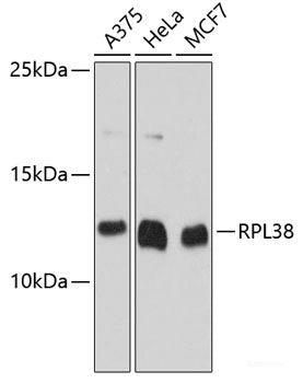Immunofluorescence analysis of HeLa cells using ALAD Polyclonal Antibody at dilution of 1:100. Blue: DAPI for nuclear staining.