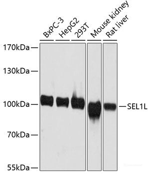 Western blot analysis of extracts of various cell lines using CD3E Antigen Polyclonal Antibody at dilution of 1:1000.