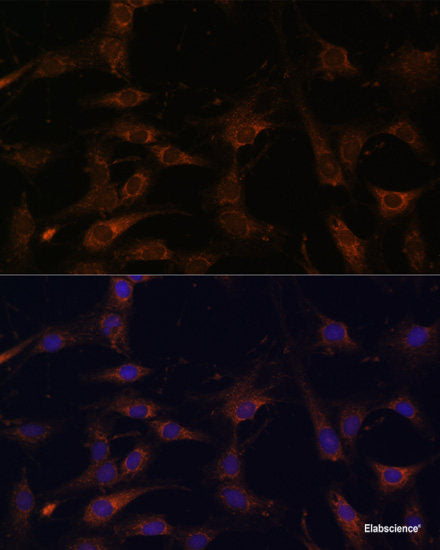 Western blot analysis of extracts of various cell lines using CLTC Polyclonal Antibody at dilution of 1:1000.