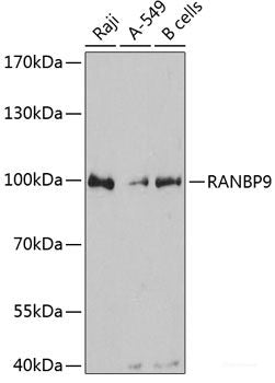 Immunofluorescence analysis of HeLa cells using Ataxin 3 Polyclonal Antibody