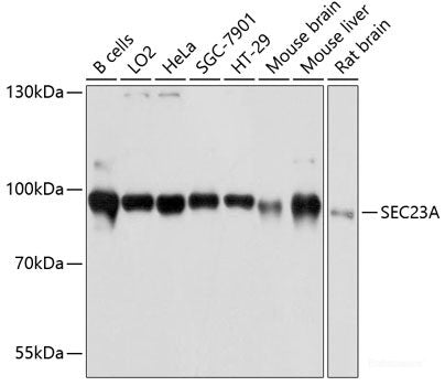 Immunohistochemistry of paraffin-embedded Rat testis using HEXA Polyclonal Antibody at dilution of 1:100 (40x lens).