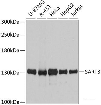 Western blot analysis of extracts of various cell lines using NTF3 Polyclonal Antibody at dilution of 1:1000.
