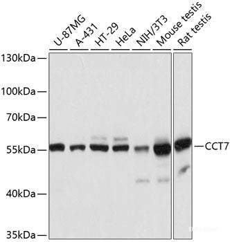 Immunohistochemistry of paraffin-embedded Rat lung using PI3 Polyclonal Antibody at dilution of 1:100 (40x lens).