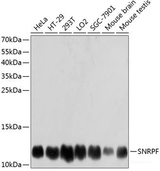 Western blot analysis of extracts of various cell lines using RAG2 Polyclonal Antibody at dilution of 1:1000.