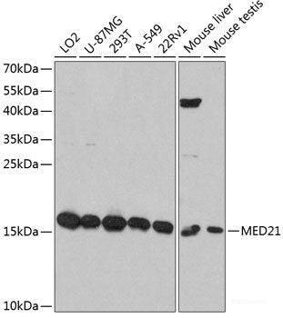 Immunohistochemistry of paraffin-embedded Rat testis using VAMP2 Polyclonal Antibody at dilution of 1:100 (40x lens).