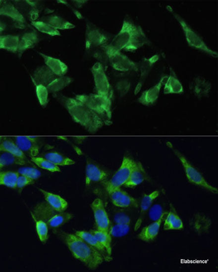 Immunohistochemistry of paraffin-embedded Human esophagus using SELP Polyclonal Antibody