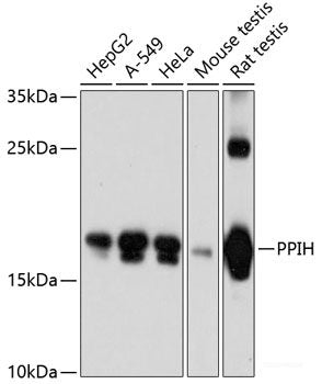 Immunofluorescence analysis of HeLa cells using ST6GAL1 Polyclonal Antibody
