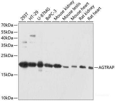 Immunohistochemistry of paraffin-embedded Rat heart using SMN2 Polyclonal Antibody