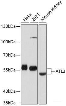 Immunohistochemistry of paraffin-embedded Mouse liver using TOP1 Polyclonal Antibody at dilution of 1:100 (40x lens).