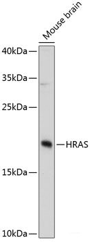 Western blot analysis of extracts of Mouse kidney using UBE2A Polyclonal Antibody at dilution of 1:1000.