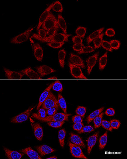 Immunohistochemistry of paraffin-embedded Human stomach using VIP Polyclonal Antibody