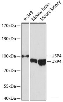 Immunofluorescence analysis of A549 cells using PIP4K2B Polyclonal Antibody