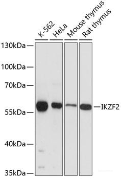 Immunohistochemistry of paraffin-embedded Rat brain using WISP2 Polyclonal Antibody at dilution of 1:100 (40x lens).