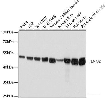 Western blot analysis of extracts of various cell lines using CHRFAM7A Polyclonal Antibody at dilution of 1:1000.