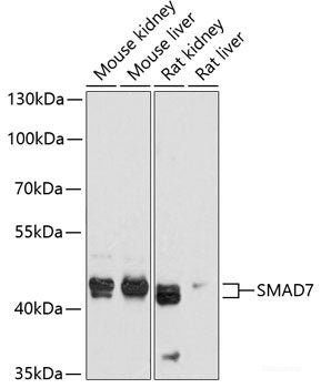 Immunohistochemistry of paraffin-embedded Human stomach using IL33 Polyclonal Antibody