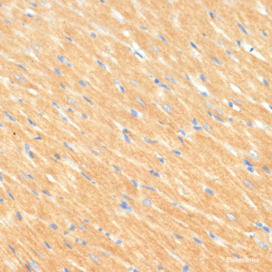 Western blot analysis of extracts of Mouse brain using TDG Polyclonal Antibody.